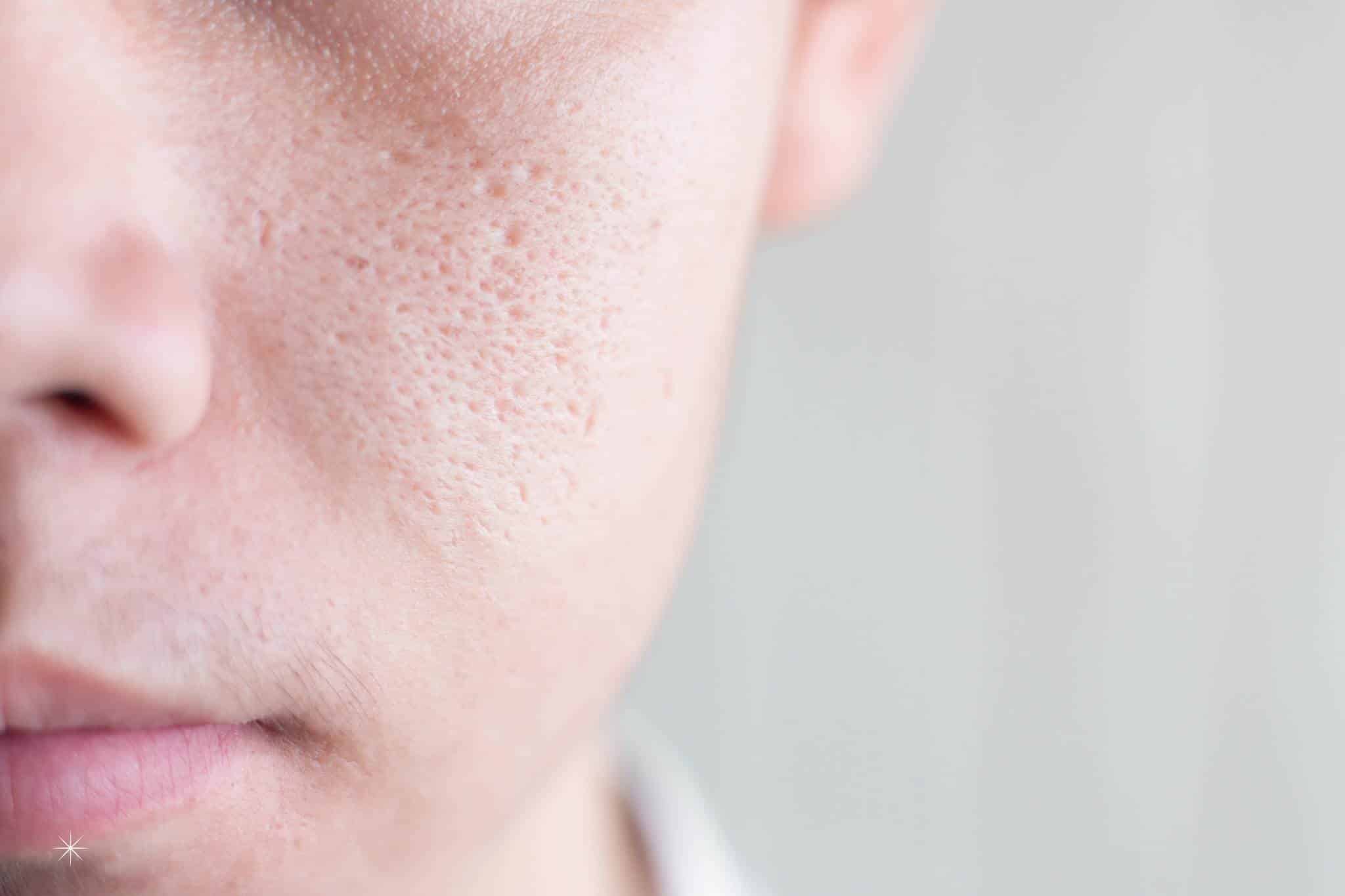 men anti-aging skincare featured pores